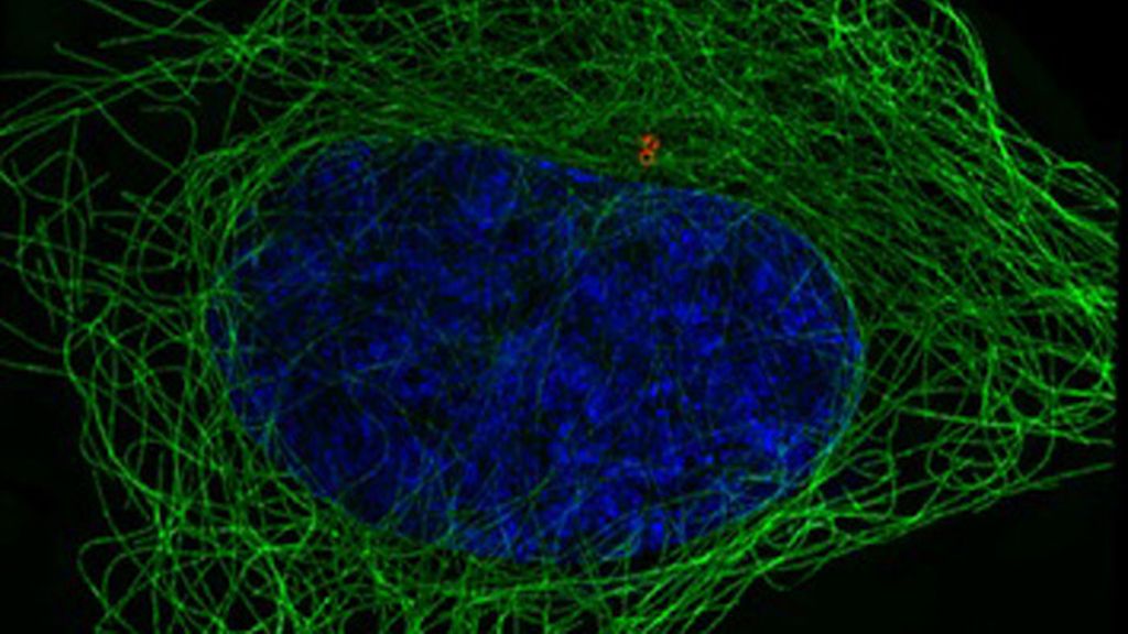 Virus, parásitos y bacterias a la vista del ojo