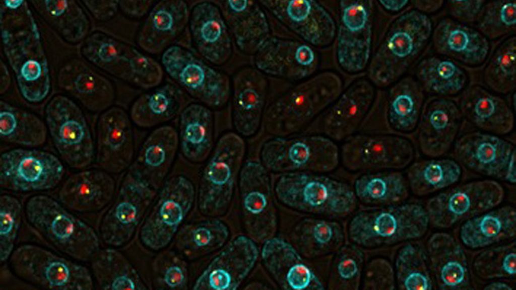 Virus, parásitos y bacterias a la vista del ojo
