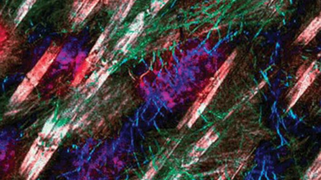 Virus, parásitos y bacterias a la vista del ojo