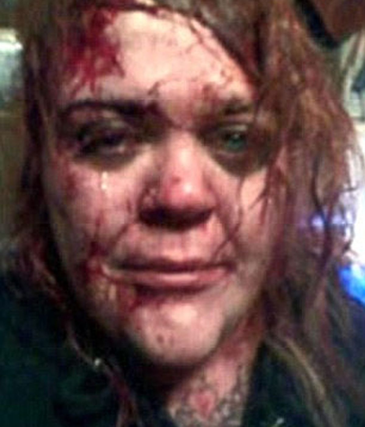 Una mujer cuelga un impactante 'selfie' en Facebook para buscar ayuda tras un ataque