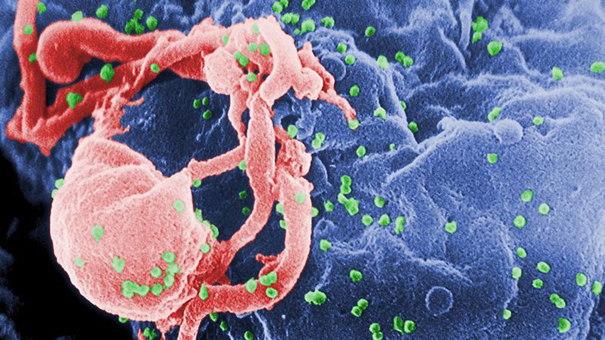 Científicos utilizan con éxito el VIH para curar dos enfermedades genéticas