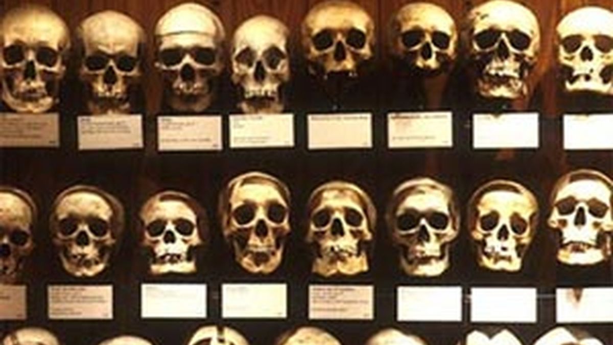 En el Mütter Museum se encuentran todo tipo de tumores y malformaciones que ha dado lugar la anatomía humana.