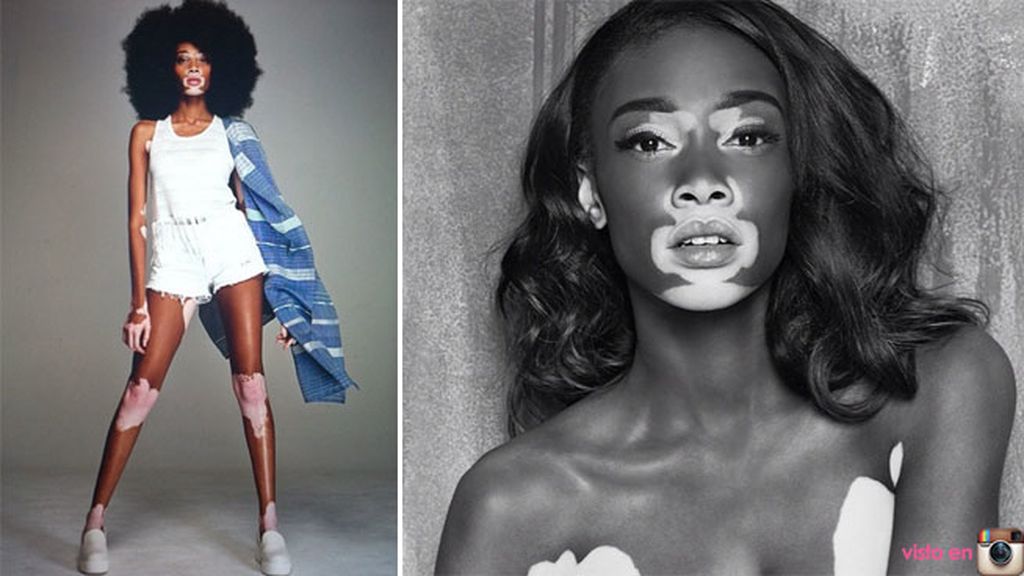 En entrevistas ha confesado que tuvo que luchar con los insultos como cebra o vaca