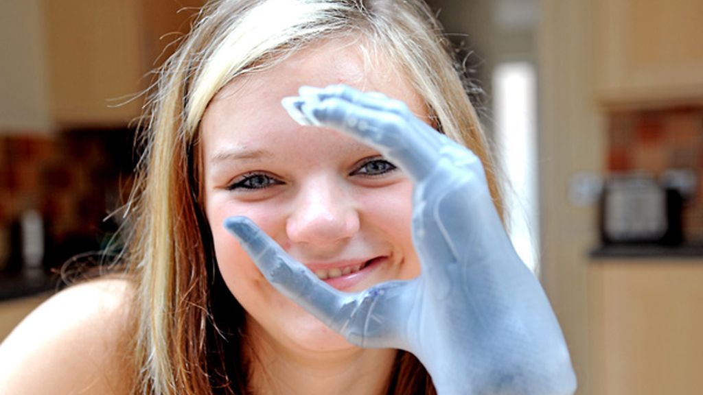 Feliz con sus nuevos dedos