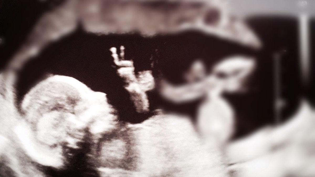 Una ecografía muestra a un bebé haciendo el signo de la paz