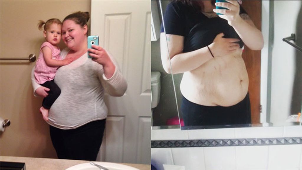 Sin complejos tras el emabrazo