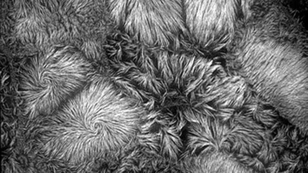 Virus, parásitos y bacterias a la vista del ojo