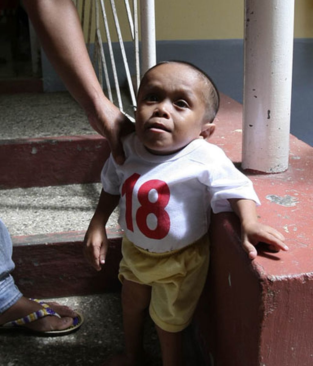 El hombre más pequeño del mundo