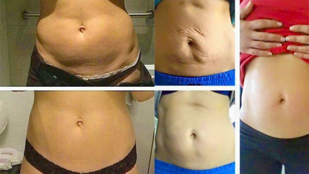 Sin complejos tras el emabrazo