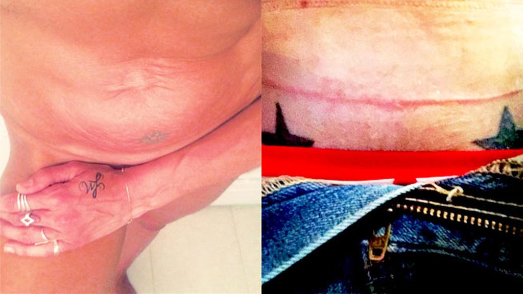 Sin complejos tras el emabrazo