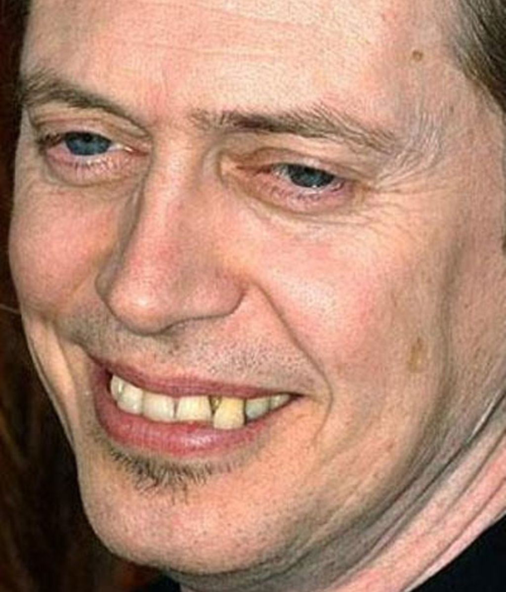 Ponte brackets