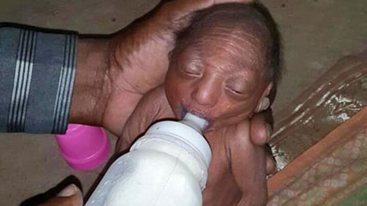 Reniengan de su bebé recién nacido por tener una enfermedad rara en la piel