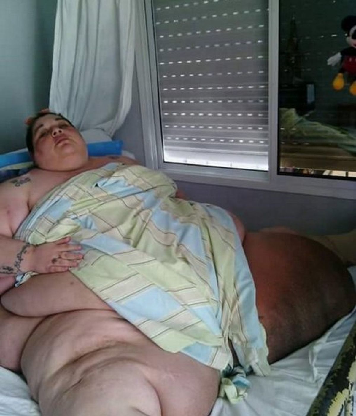 Mujer que pesa más de 400 kilos