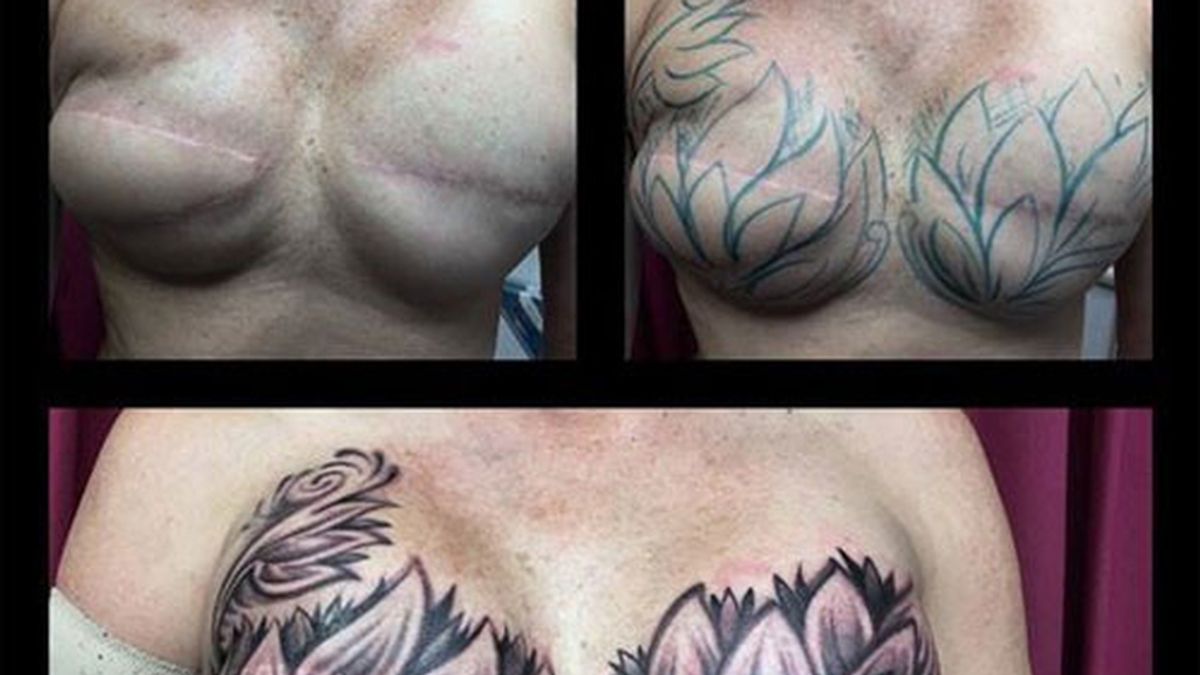 Cubre las cicatrices de su doble mastectomía con un espectacular tatuaje