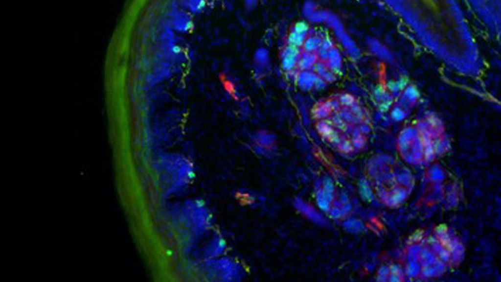 Virus, parásitos y bacterias a la vista del ojo