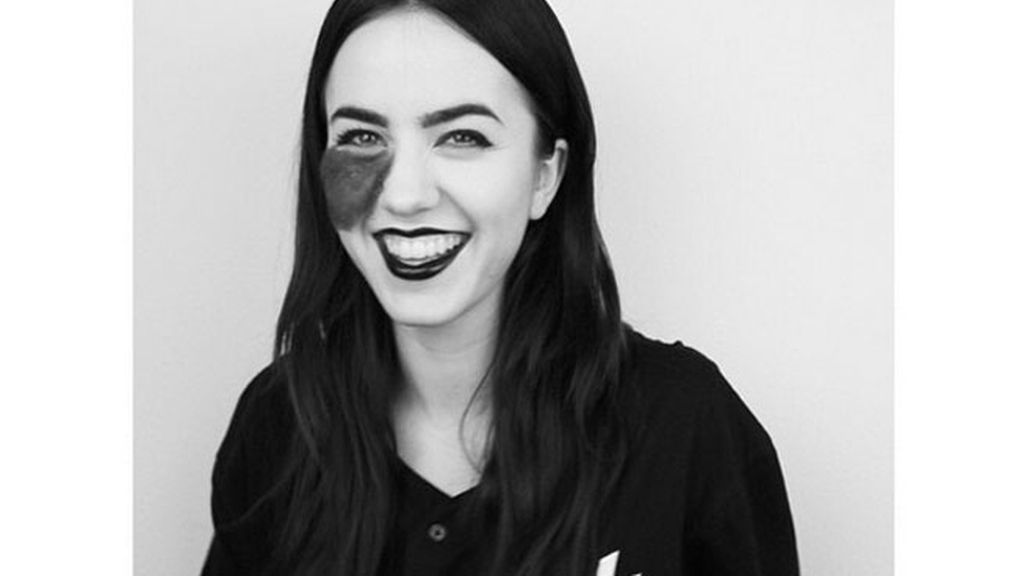 Nació con un lunar en su cara que la hace especial