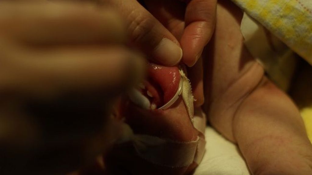 Sorpresa: Mi bebé nació con dientes