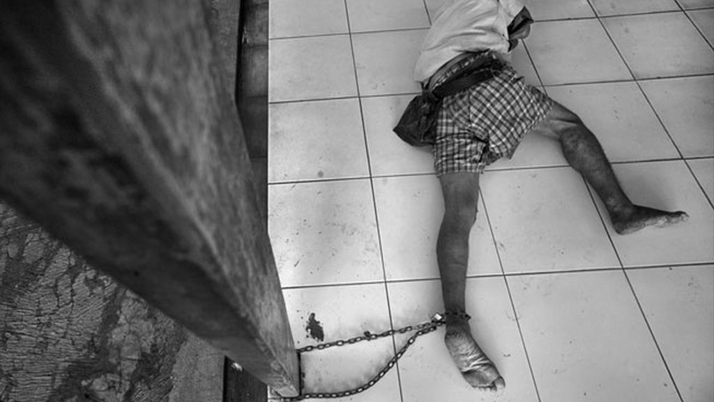 Paciente encadenado en centro de rehabilitación