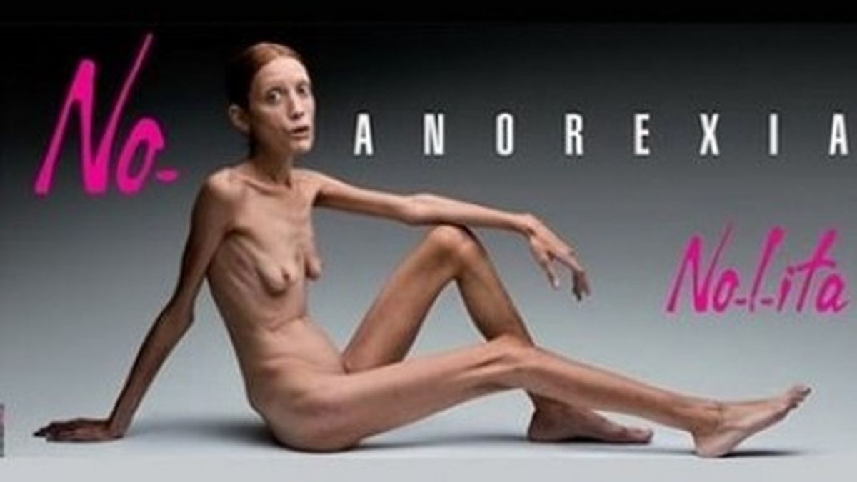 campaña contra anorexia, anorexia, trastorno alimentario, modelos anorexicas