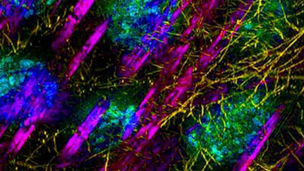 Virus, parásitos y bacterias a la vista del ojo
