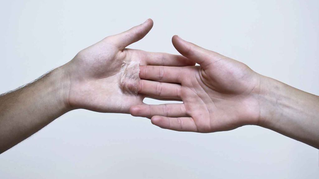 Arte hasta en la piel