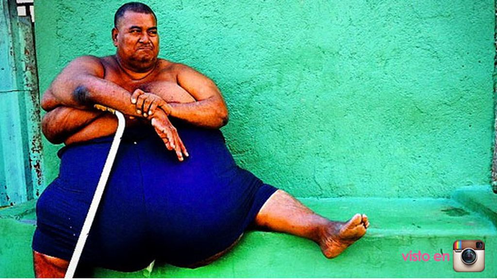 "Luis, 235 kilos, padece diabetes como el 30% de la población en Nicaragua