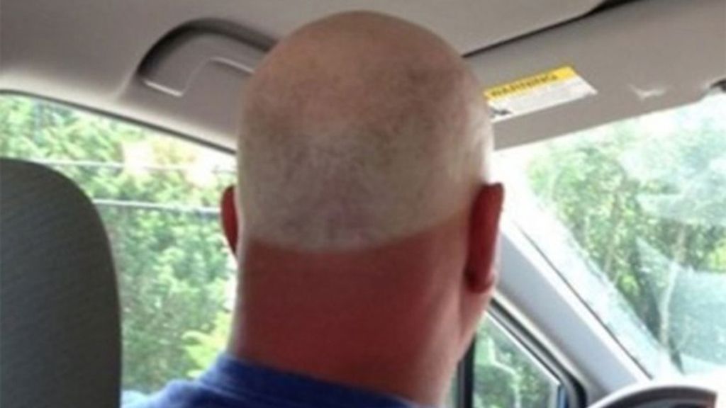 Cuando el sol te marca