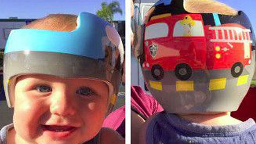 Los cascos médicos más divertidos