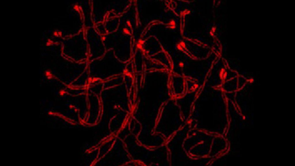 Virus, parásitos y bacterias a la vista del ojo