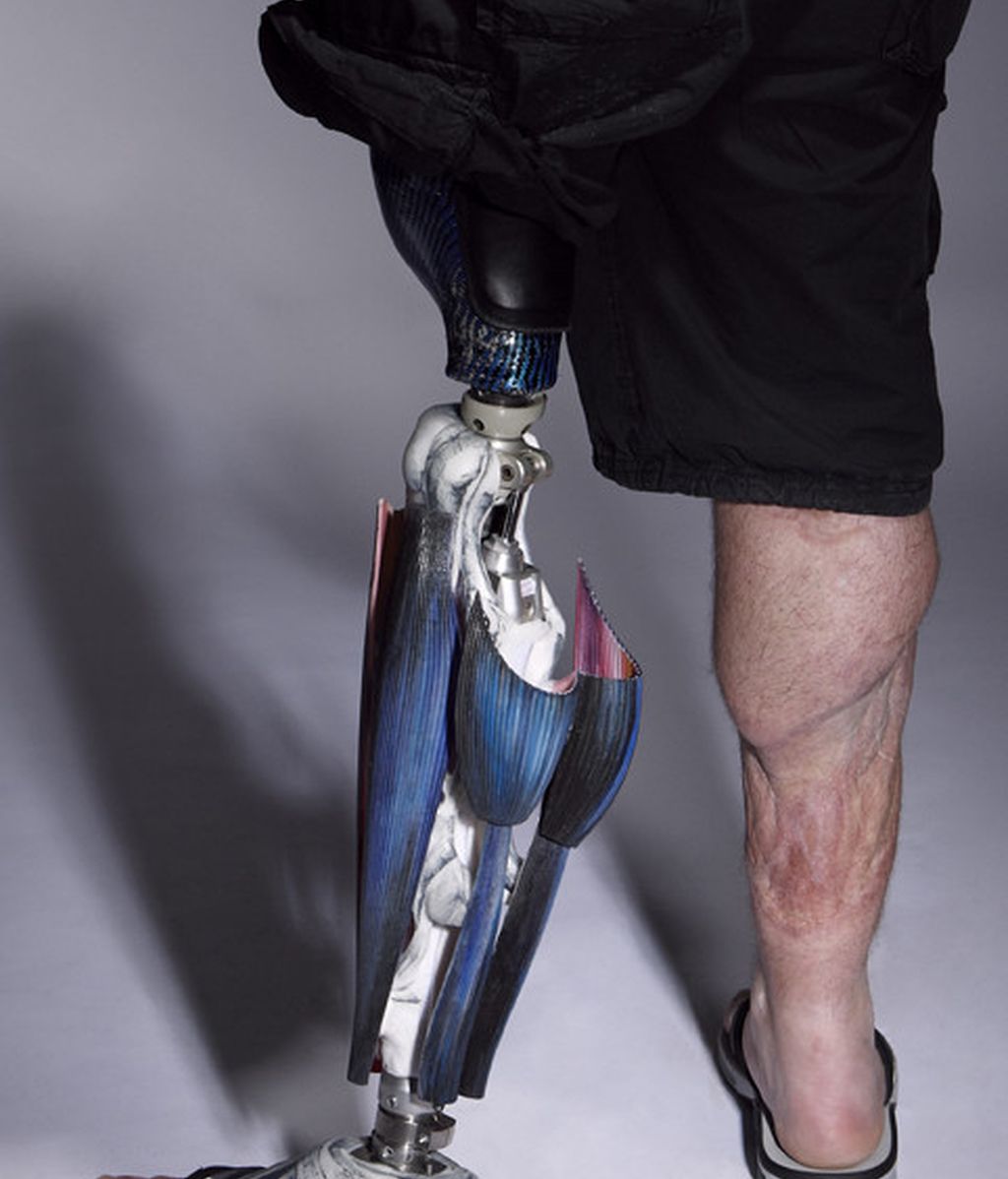 Llegan las prótesis 'fashion', el arte sin barreras