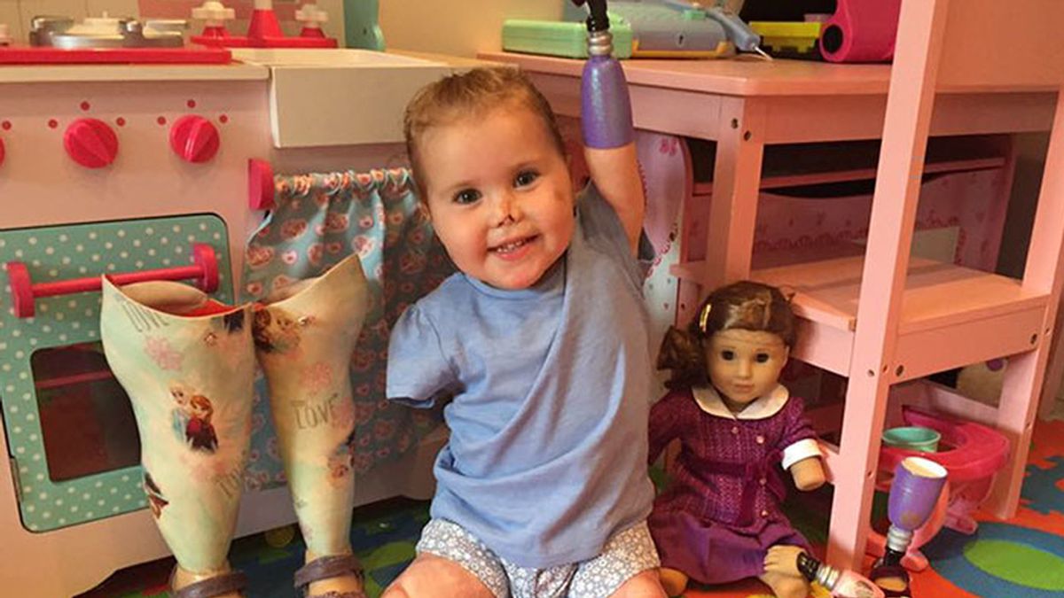 Una niña sin extremidades recibe una muñeca amputada como ella