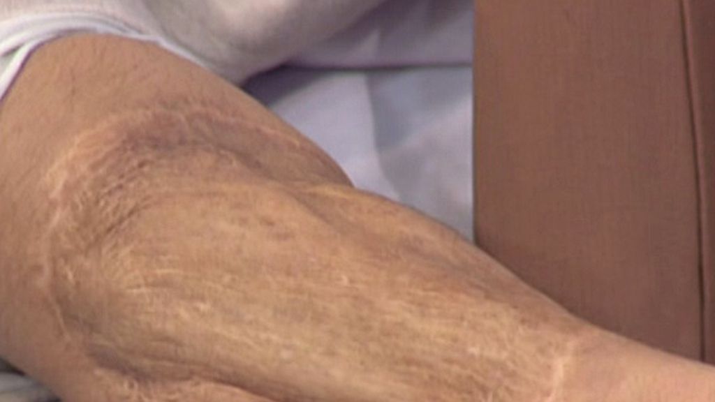 Una empleada de R. Menéndez, agredida por un mono de su zoo