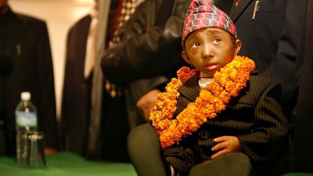 62 centímetros para ser el hombre más bajo del mundo