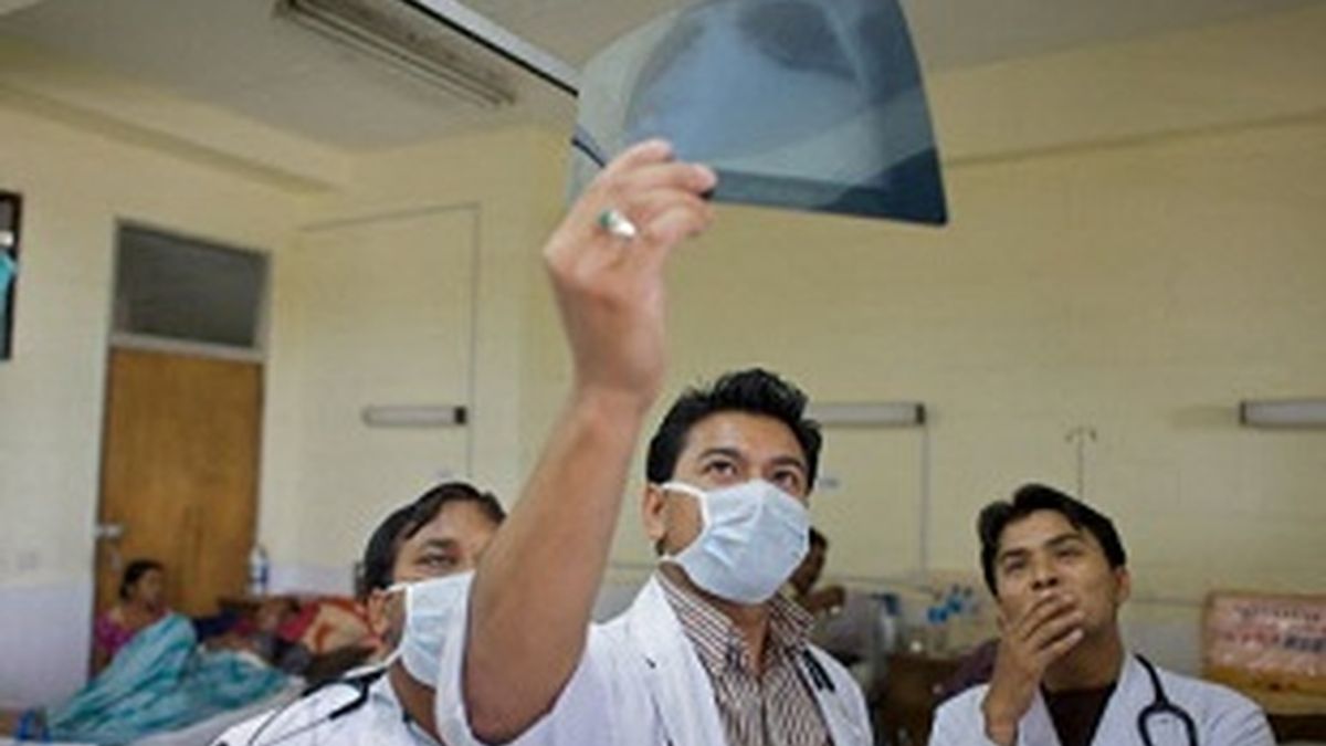 Médicos analizando una radiografía de pulmón
