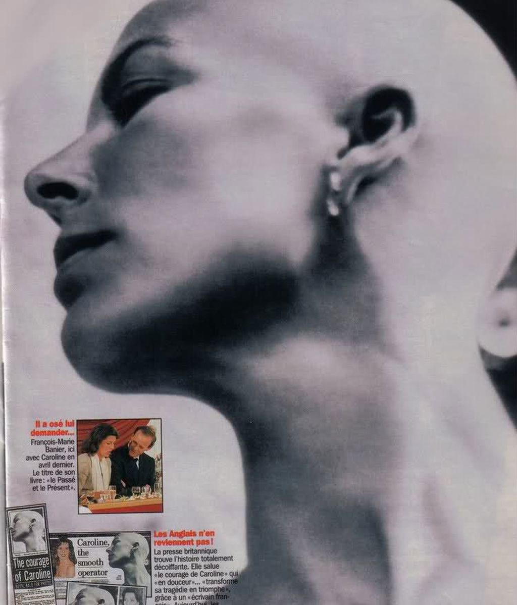 Cynthia Nixon se apunta al club de las famosas calvas