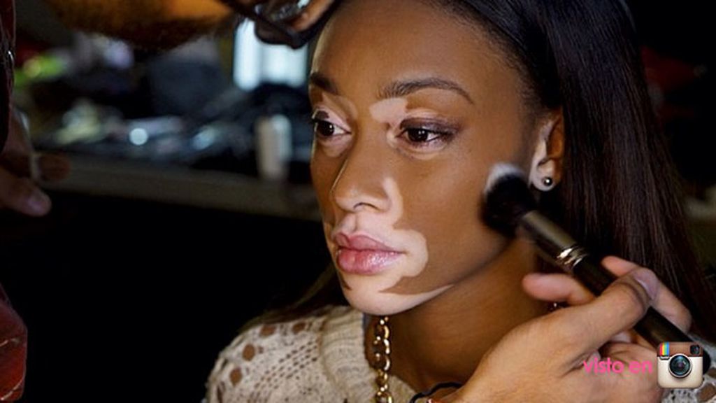 En entrevistas ha confesado que tuvo que luchar con los insultos como cebra o vaca