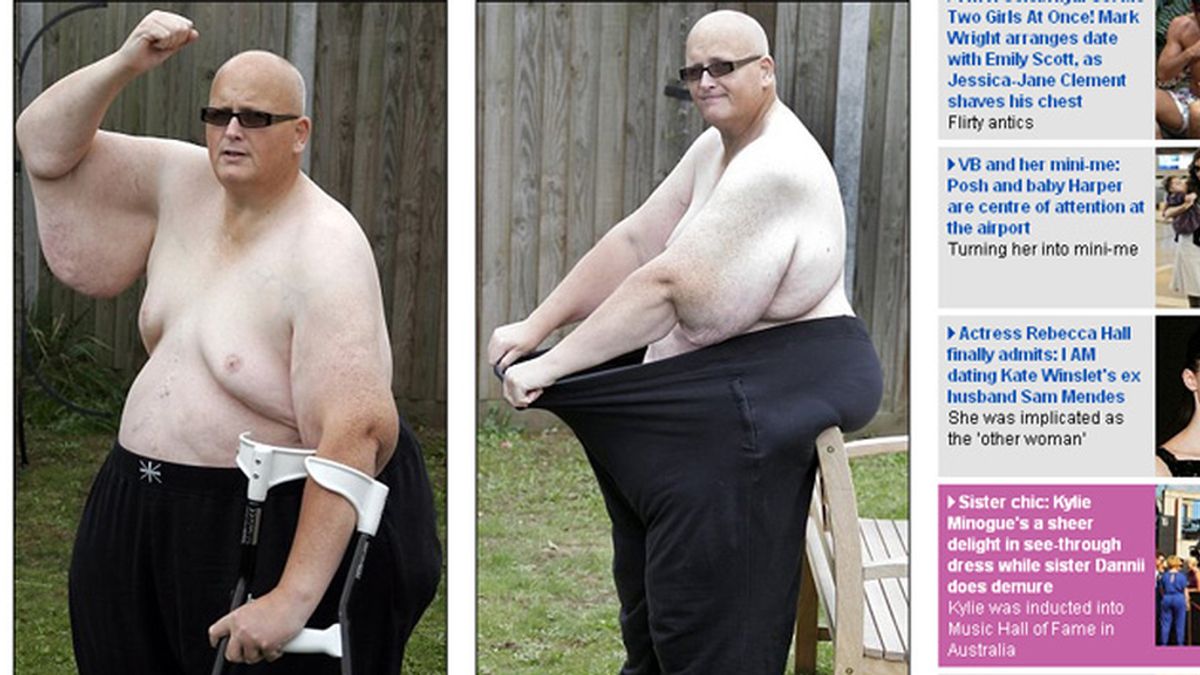 El hombre más gordo del mundo tras perder 254 kilos