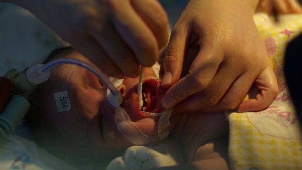 Sorpresa: Mi bebé nació con dientes