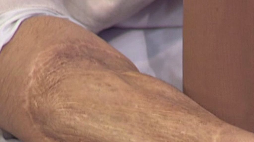 Una empleada de R. Menéndez, agredida por un mono de su zoo