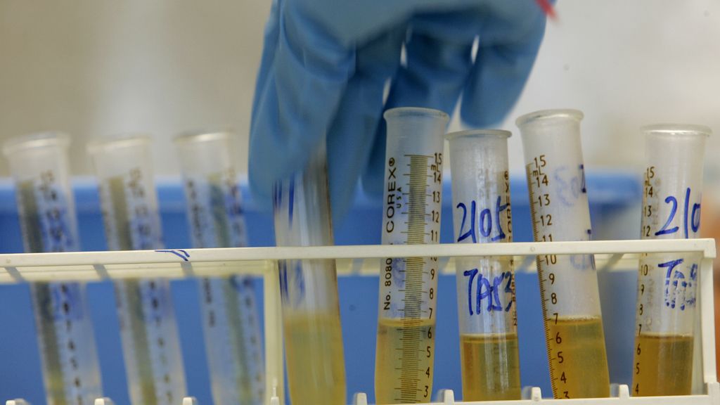 Orinoterapia para mejorar la salud