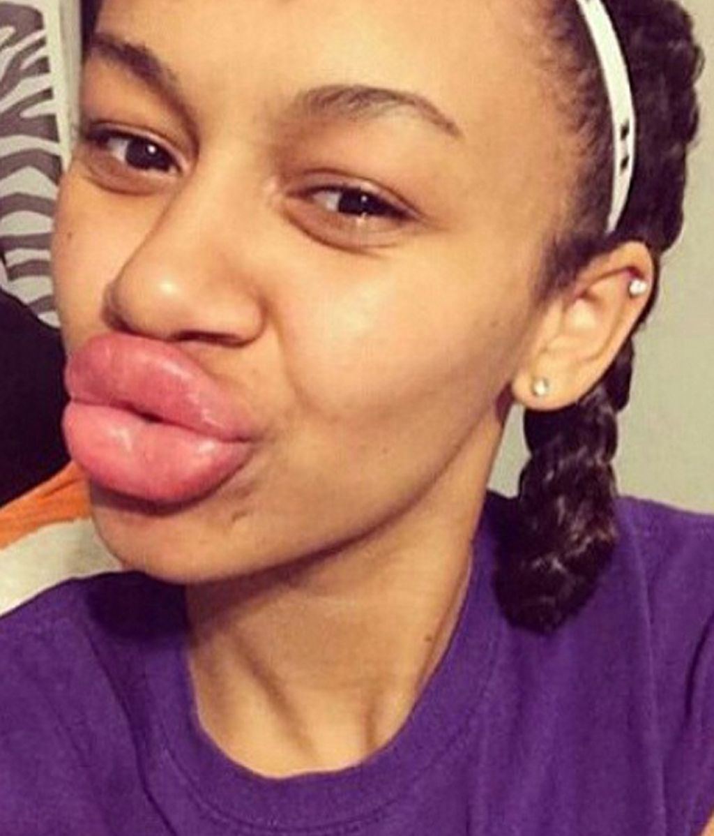 'Kylie Jenner Challenge'