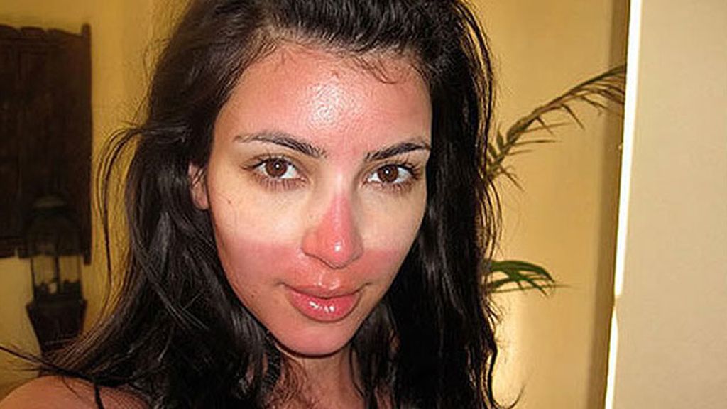 Las peores autofotos de los famosos