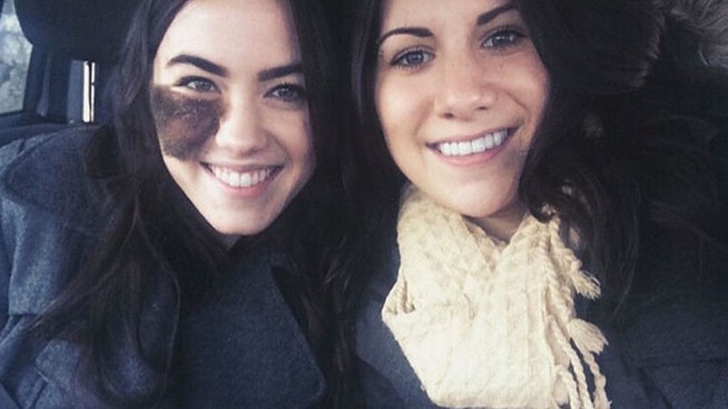 Nació con un lunar en su cara que la hace especial