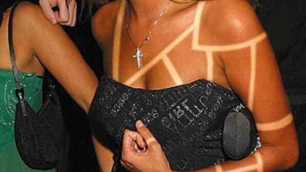 Sunburn Art, el arte de quemarse al sol