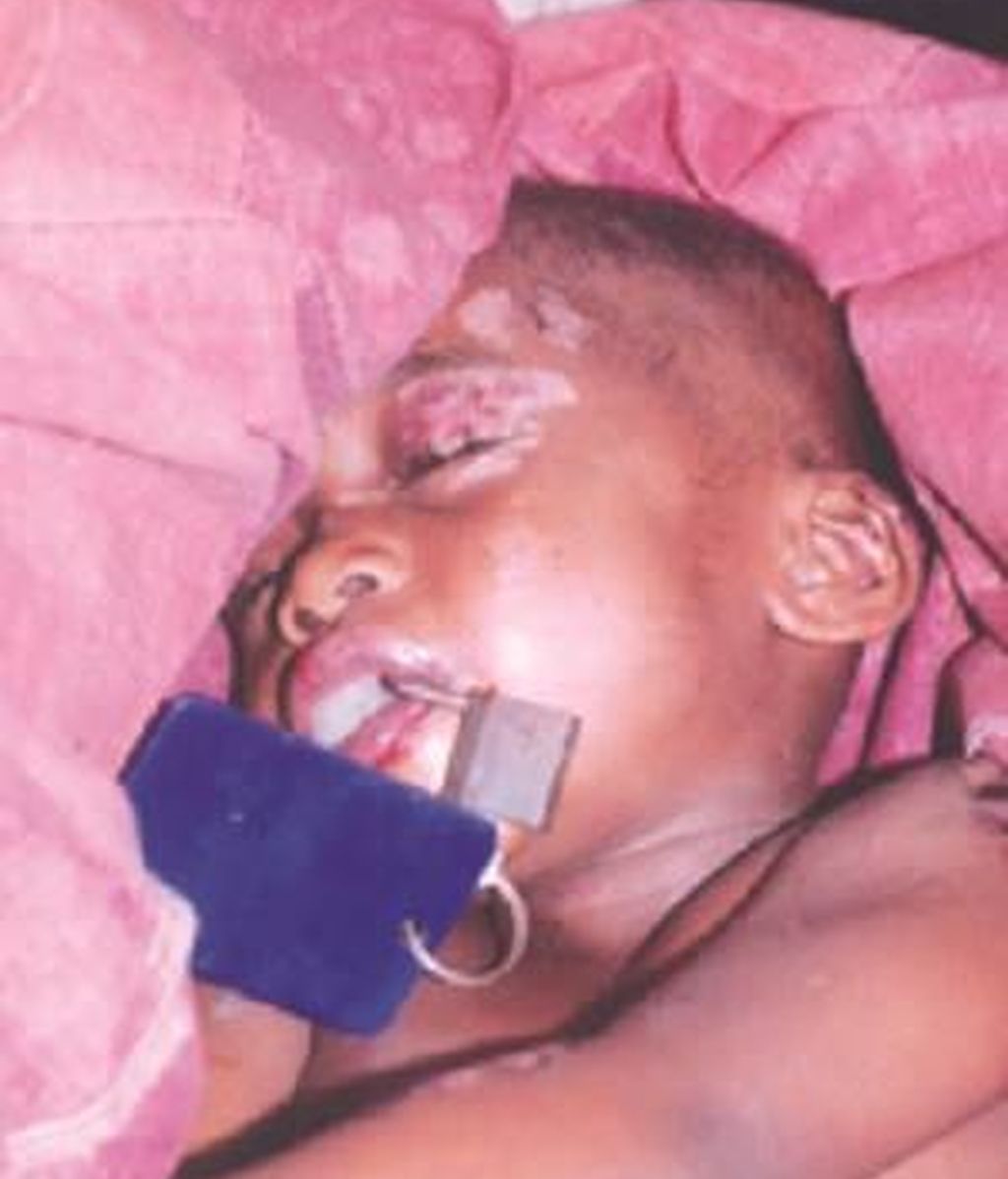 candado,boca,niño maltratado,Nigeria,Lagos,Chris Elvis,maltrato infantil