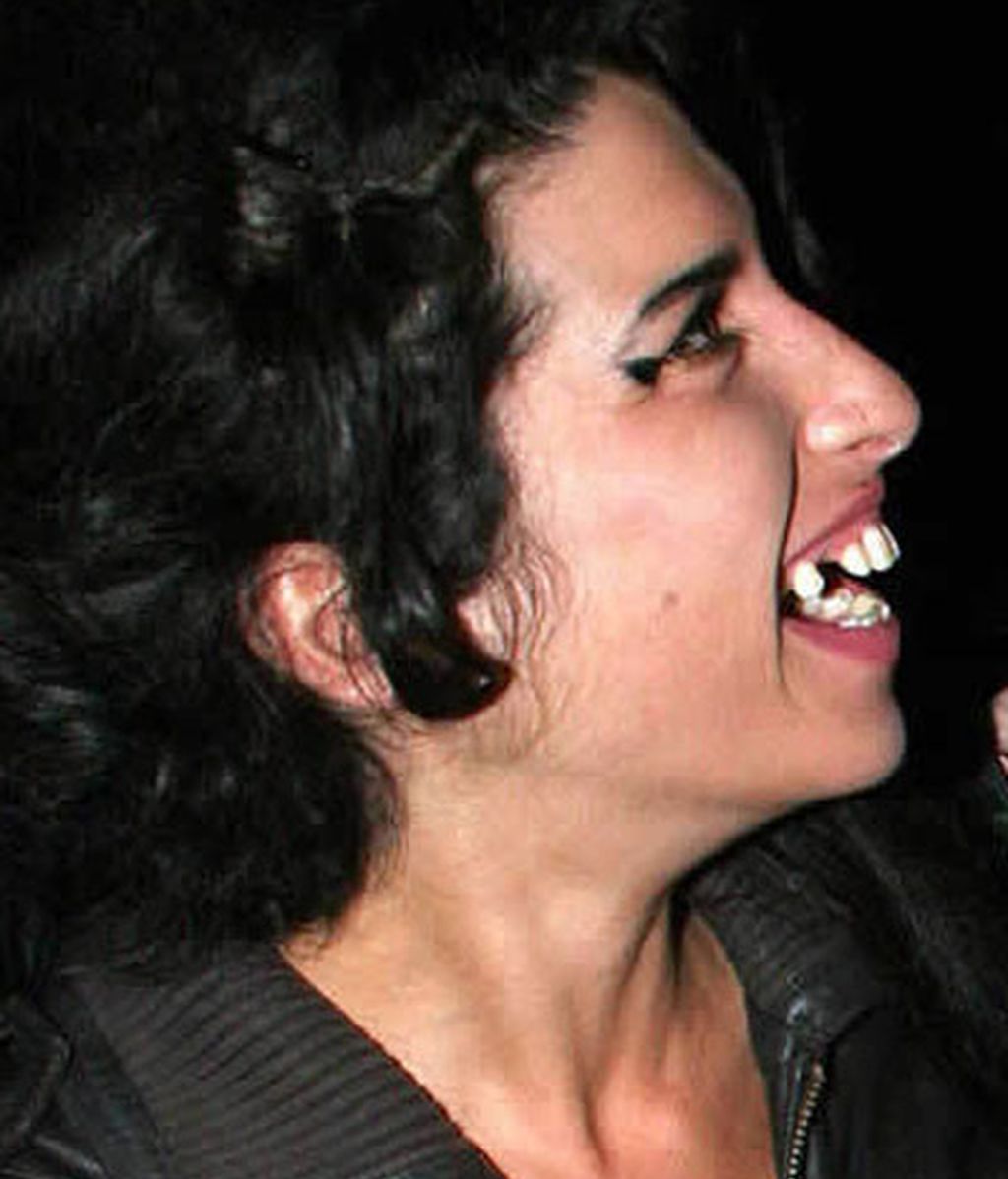 Ponte brackets