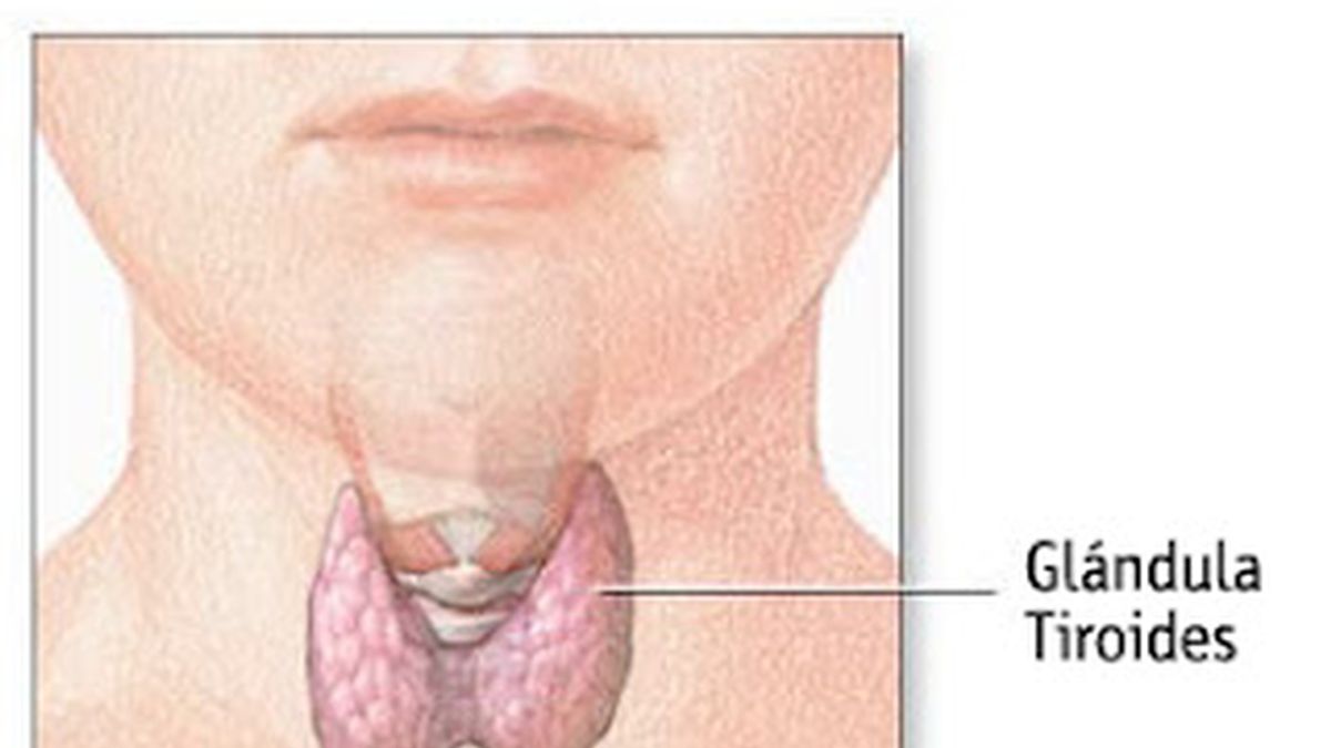 Glándula tiroidea