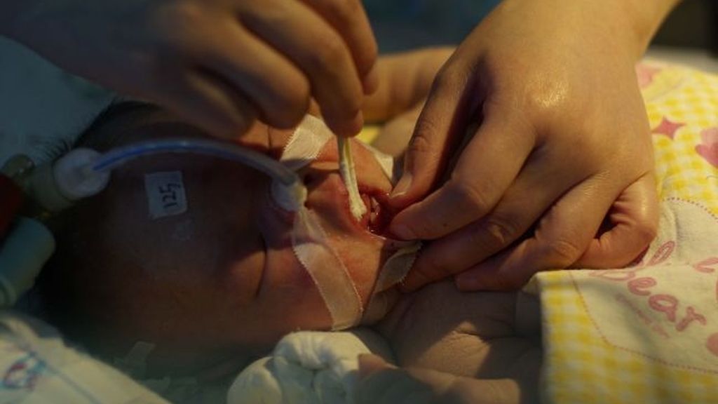 Sorpresa: Mi bebé nació con dientes