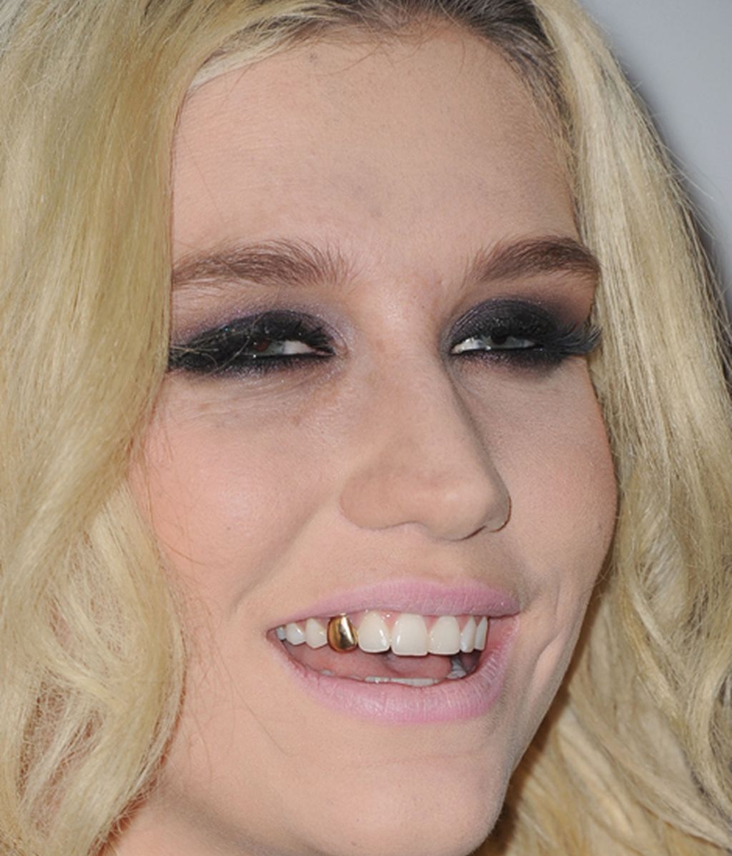 La cantante y actriz Kesha, durante el concierto anual 'Jingle Ball' de 'KIIS FM'