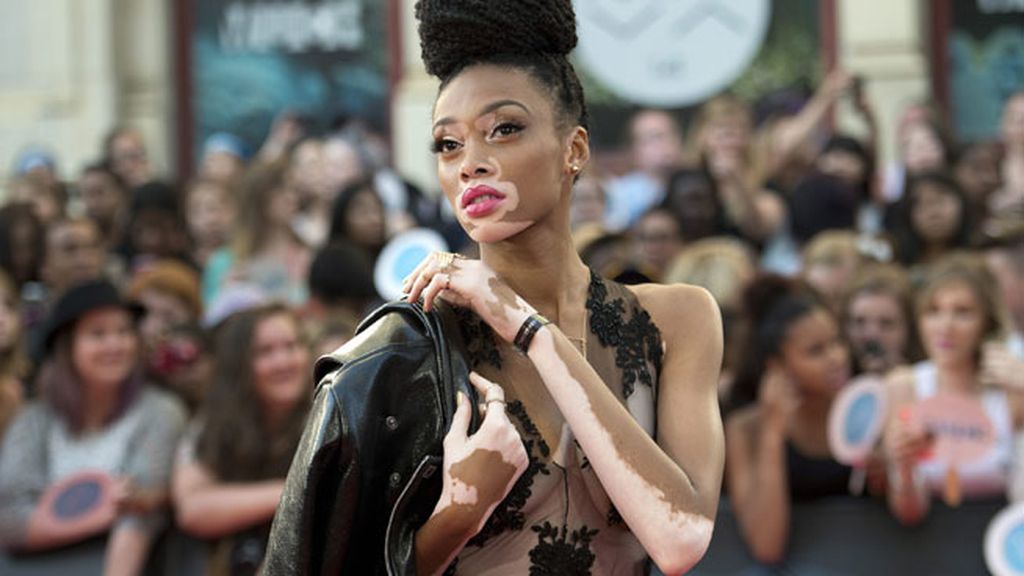 En entrevistas ha confesado que tuvo que luchar con los insultos como cebra o vaca